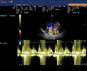 Echographie cardiaque (échocardiographie) chien