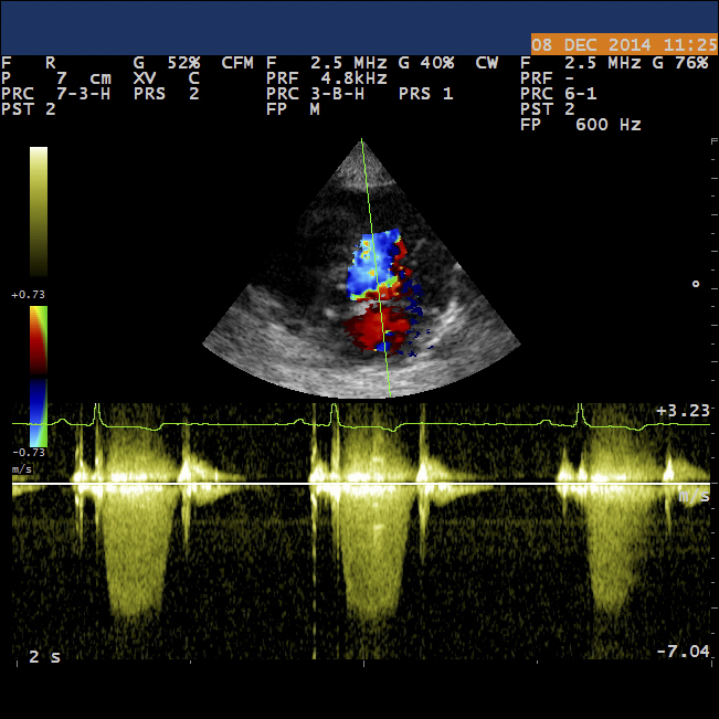 Clinique Vétérinaire Rostrenen Centre Bretagne Echographie