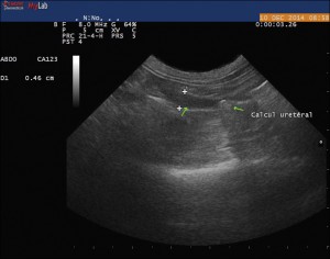 Echographie abdominale chat