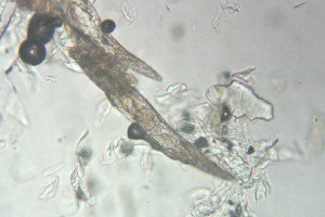 Demodex